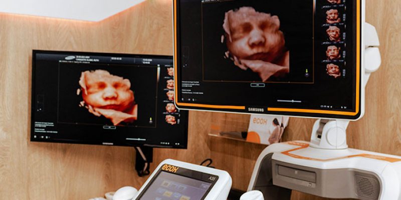 Ecox Tenerife Sur | Especialistas en Ecografía 5D Tenerife y 8K
